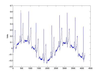 Tops Ekg Image